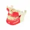 Thumbnail: Dental Implant Teeth Model Ortho Implant Practice Model with Concellous Bone