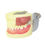 Thumbnail: Maxillary Bilateral Cyst Pus Incision and Removal Practice Dental Teeth Model