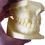 Thumbnail: Light Yellow Different Occlusion Classification Dental Malocclusion Jaw Model