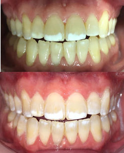 Odontología estética