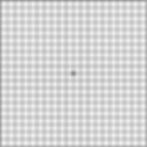 Macular Degeneration, Macular Degeneration, Age-Related Macular Degeneration, Eye Health, Eye Diseases, Vision Loss, Retinal Diseases, Risk Factors, High Blood Pressure, Genetic Predisposition, Amsler Grid Test, Eye Examination, Retinal Center, Antioxidants, Photobiomodulation, Wet Type Macula Degeneration, Dry Type Macular Degeneration, Drug Treatment, Photodynamic Therapy, Vision Rehabilitation, Valeda Light Transmission System, Yellow Spot Disease price, istanbul, izmir, Antalya, Muğla, Aydın, Denizli, Ankara