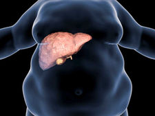 The Effects of Obesity on Health and the Diseases It Causes