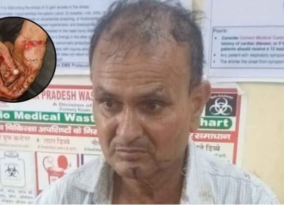 कानपुर: दिनदहाड़े सराफा व्यापारी पर चाकू से हमला, 15 लाख से अधिक की लूट