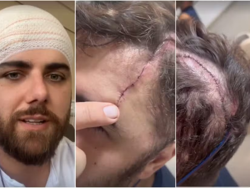 Cantor sertanejo Zé Neto enfrentou dois acidentes em menos de um ano; relembre os acontecimentos.