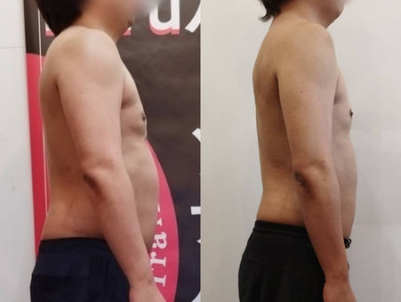  [ビフォーアフター]4０代