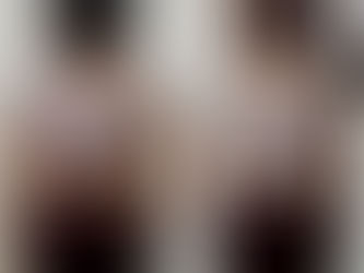 [ビフォーアフター]30代