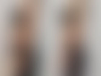  [ビフォーアフター]3０代　