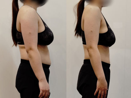  [ビフォーアフター]2０代