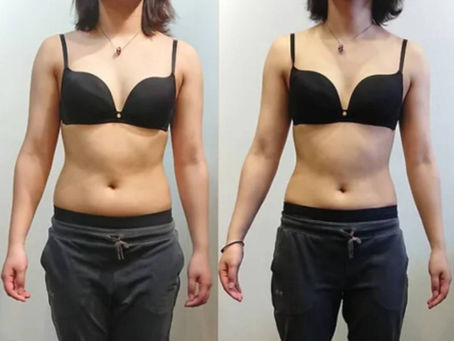 [ビフォーアフター]2０代