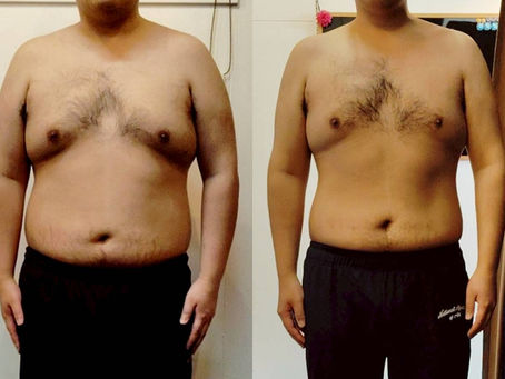 [ビフォーアフター]2０代