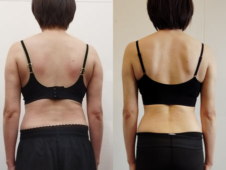 [ビフォーアフター]4０代