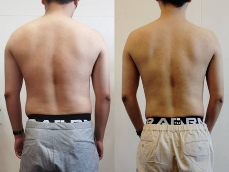 [ビフォーアフター]4０代