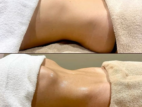 Top 10 Benefits of Lymphatic Massage for Overall Health and Wellness Laureles, Medellin