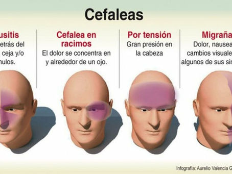 MIGRAÑAS, CEFALEAS, DOLORES DE CABEZA CRONICOS.