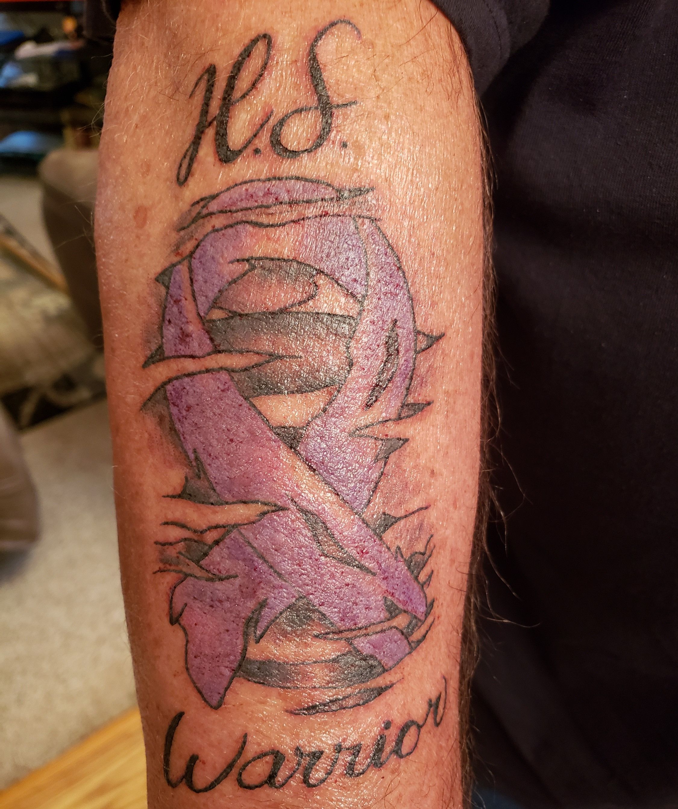 Tattoos Hidradenitis Suppurativa Hs Connect Online