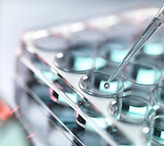 ImmunoCAP Isac - Dra Marcia Toraiwa explica