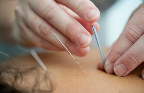 Unlike acupuncture, this technique focuses on the underlying muscular trigger points to manage neuromusculoskeletal pain, movement impairments and helps trigger healing responses in the body.