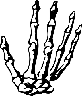 Black Lich skeleton hand