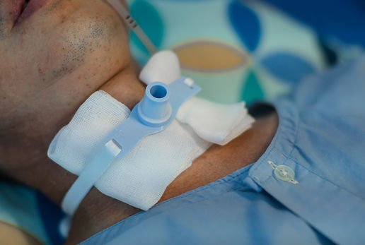 Patient with tracheostomy tube for breat