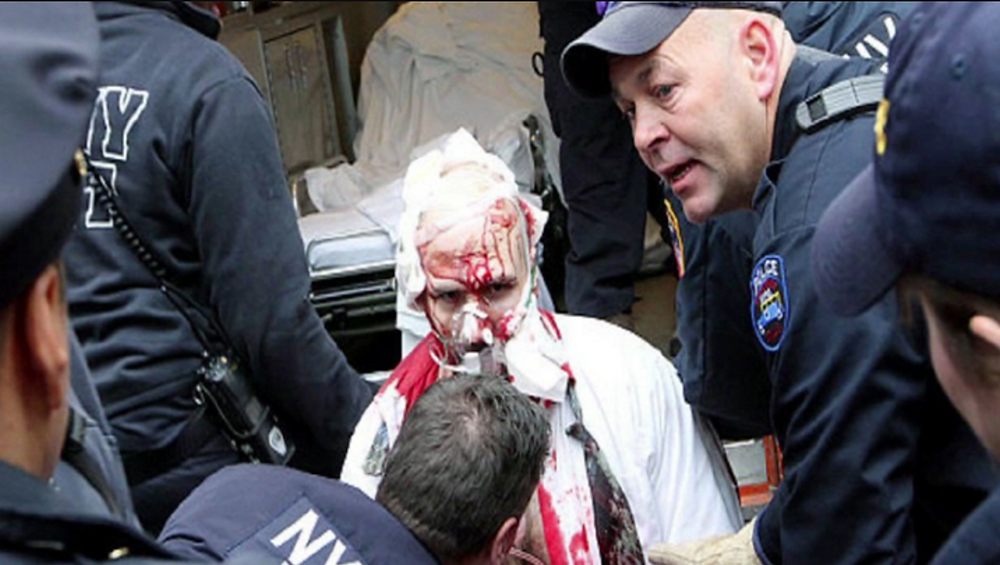 An injured Joseph Lozito is treated following stopping a deadly knife attack on the New York subway. (Photo: NY Daily News)
