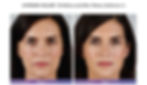 170192_Downloadable B_A_Catherine_HR-3_e