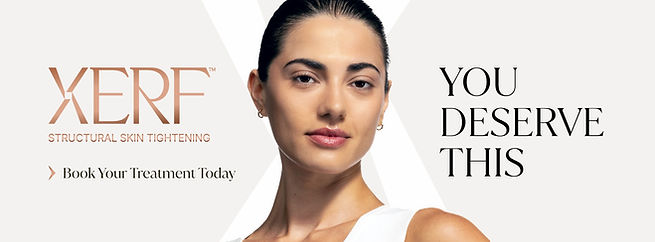 4540840925-XERF-YouDeserveThis-FB-Banner.jpg