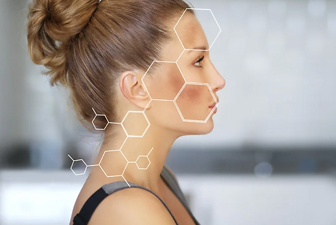 Pigmentation Removal Laser
