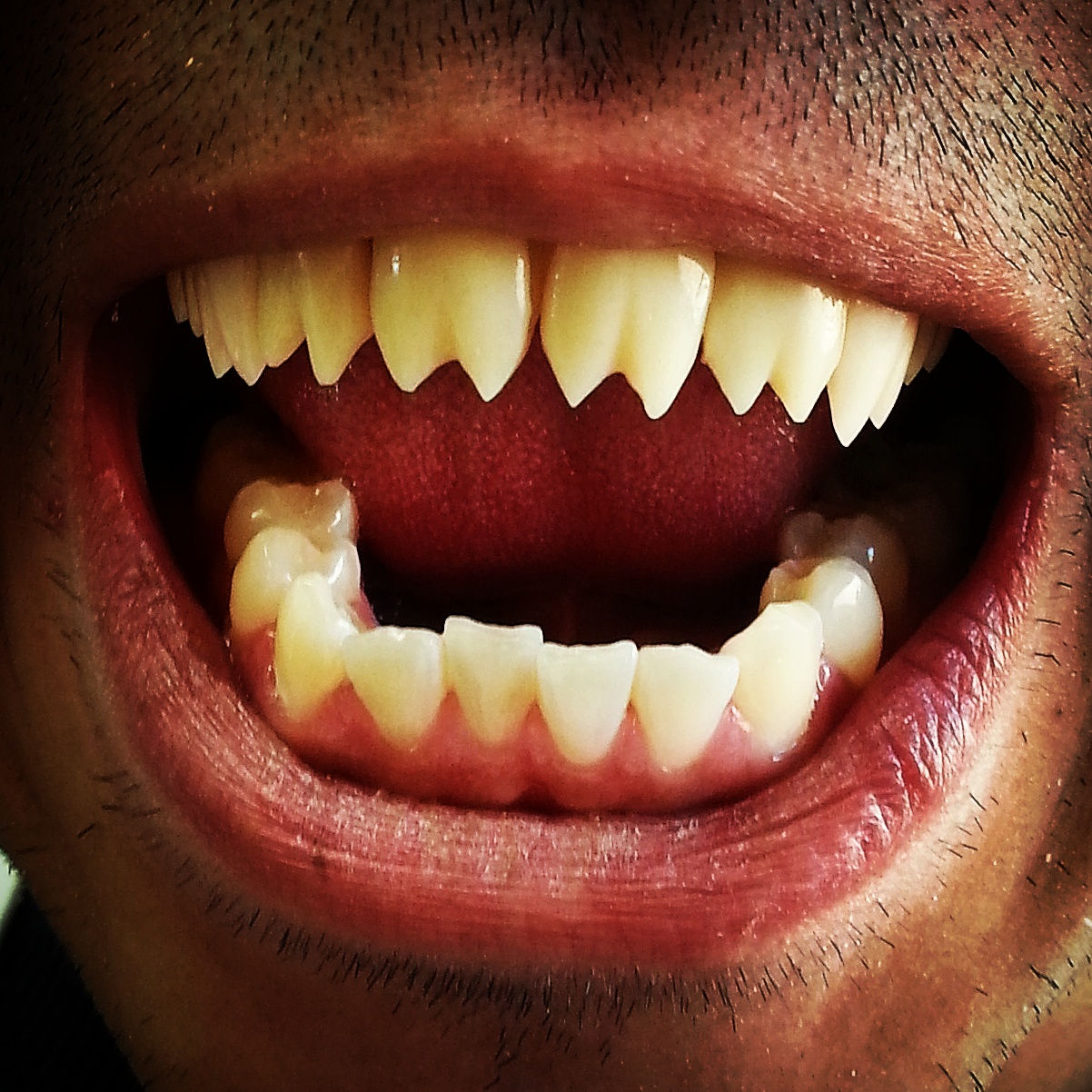 "Piranha"  Mouth Upper