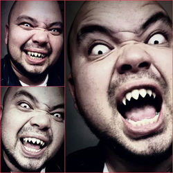 Fangs By Custom Fangz