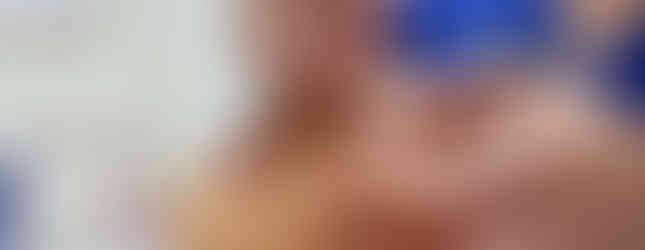 肌膚檢測, 做臉, 美容, 保養, 醫美, facial, skincare, 護膚, 台北美容, 台北做臉, 台北臉部保養, 公館做臉, 無痛清粉刺, 電波拉提, 角質管理, 水楊酸, 去角質, salycilic acid, exfoliate, painless extraction, remove acne marks, remove freckles, 做臉 before after, 做臉比較, 做臉成效, 做臉效果, 台電大樓做臉, 公館做臉, 台大做臉