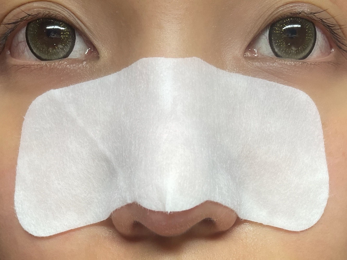 remove blackheads, blackheads removal reddit, blackhead removal facial, blackhead whitehead, salicylic acid, webMD, blackheads on cheeks, how to close pores after removing blackheads reddit