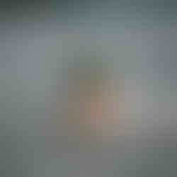 Prosthetic arm for surfing