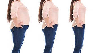 Weight Loss surgery