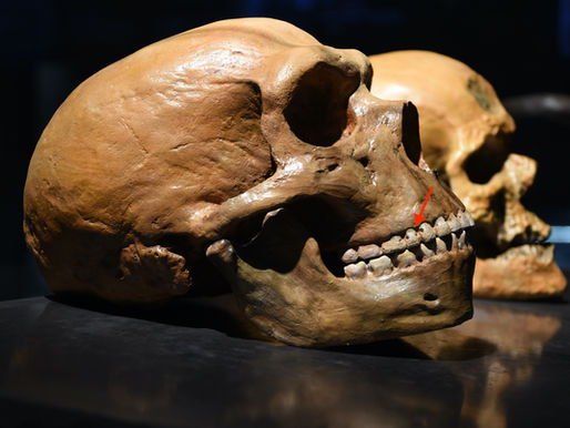 Incredible Ways That Ancient People Treated Cavities