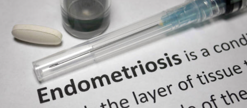 Infertility Endometriosis Treatment