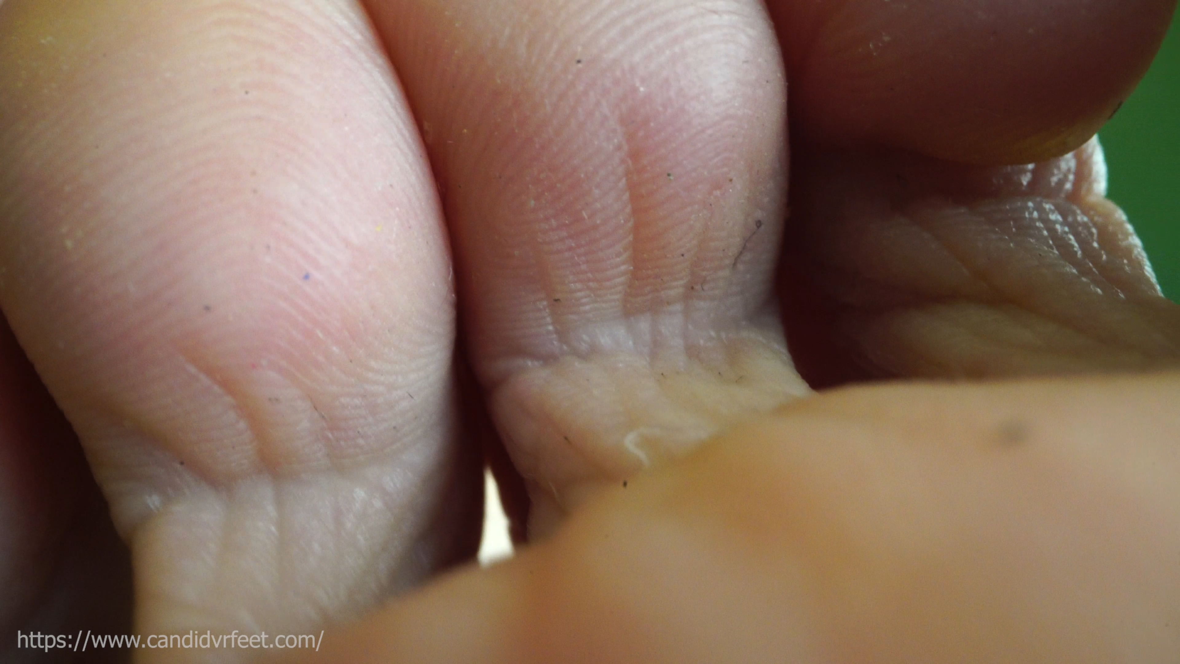 Exploring Elsa's toe gaps