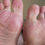 Thumbnail: Yurino's meaty soles (4K60 06)