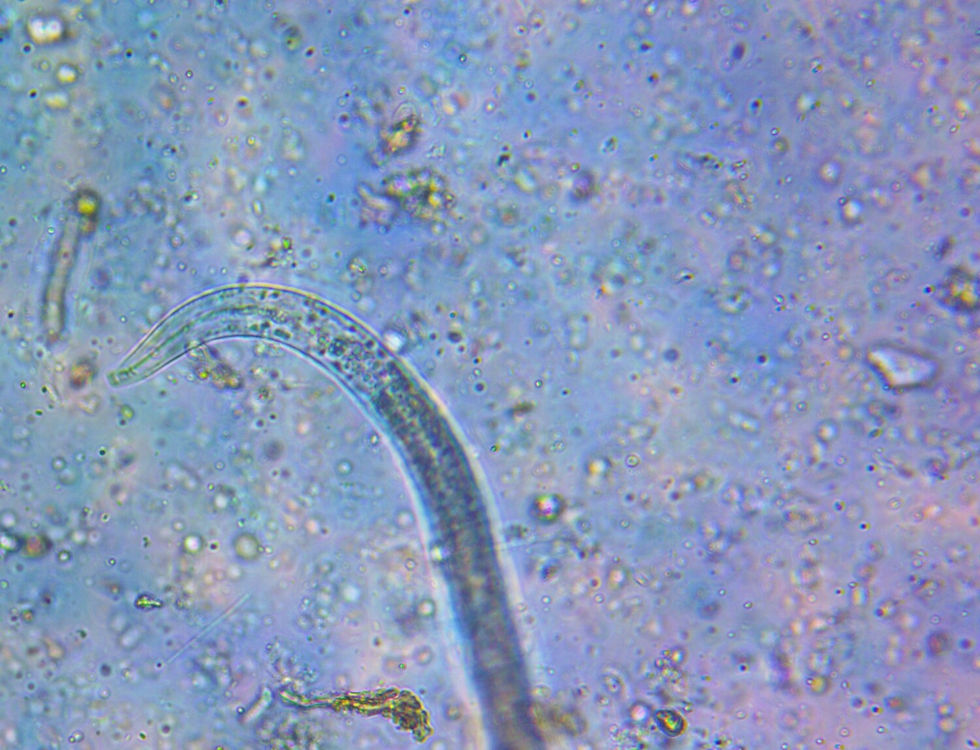 A close-up of a nematode, a microscopic soil organism, exemplifying the diverse life within the soil ecosystem, as discussed in the blog post.