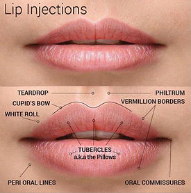 Lip Injections.jpg