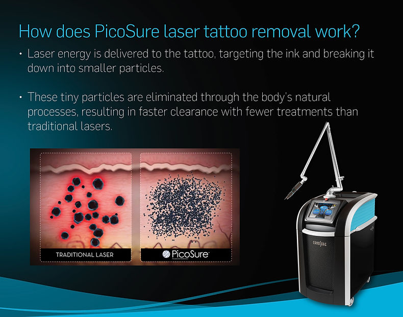PicoSure how it work