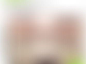 Under-Eye Bags: Why WJ‑MSC Works Better Than Filler