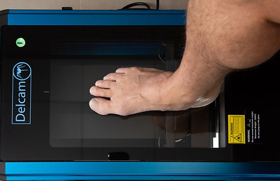 3D Voetscan