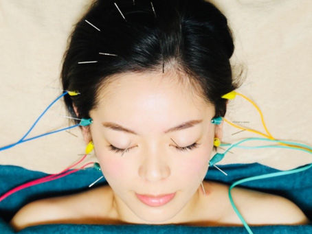 【銀座】美容鍼にはどのくらいの頻度で通うべき?エステとの違いとは 🌟