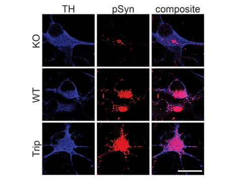 α-synuclein KOs generated from SNCA triplication patient.
