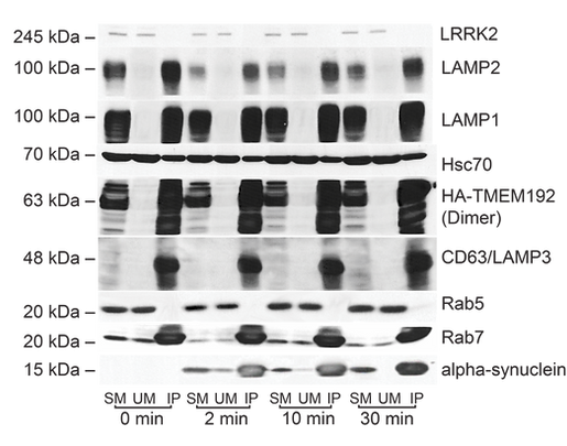 Lysosomes were purified from cells expressing HA-tagged TMEM192-RFP using HA-magnetic bead immunoprecipitation.