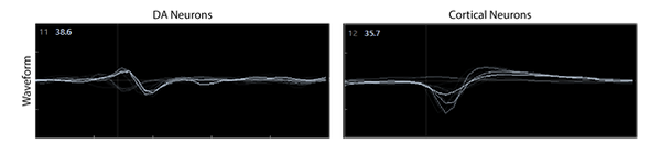 Waveforms from individual electrodes to assess action potential.