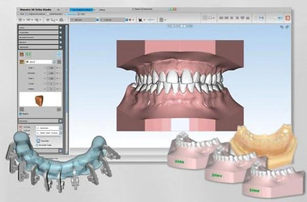 shining-3d-and-age-solutions-team-up-accelerate-digital-dental-solution-1.jpg