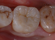 Fig.14.JPG