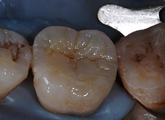 Fig.13.JPG