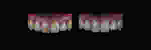clareamento dental antes e depois